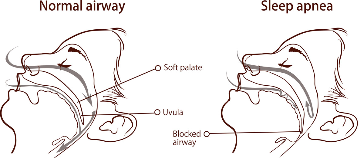 Unused CPAP machine with other abandoned items in a pile of stuff in the basement